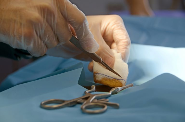 美しい笑顔を手に入れる！おすすめの歯科矯正法完全ガイド